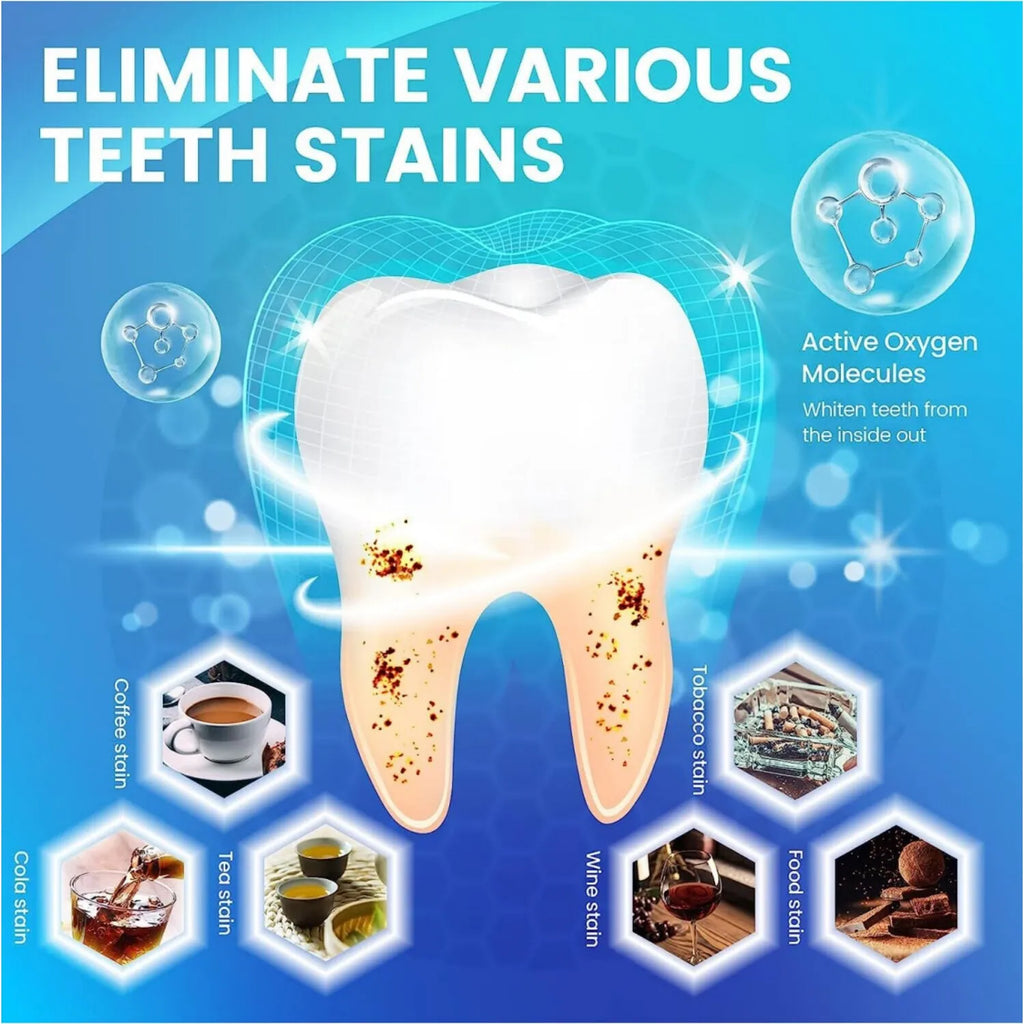 7/14/28 pares de tiras blanqueadoras de dientes para dientes, tiras blanqueadoras 5D/9D tiras blancas de sensibilidad reducida para blanqueamiento dental