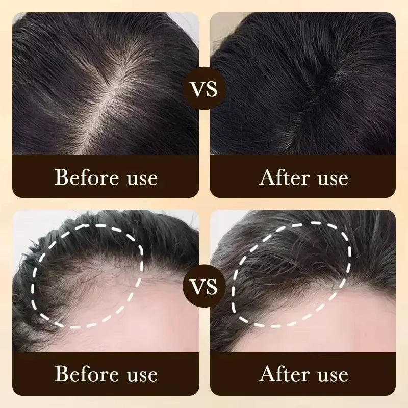 Tratamiento esencial para el crecimiento del cabello, fortalece el cabello, nutre el cuero cabelludo, peso ligero, no graso, mejora la circulación del cuero cabelludo