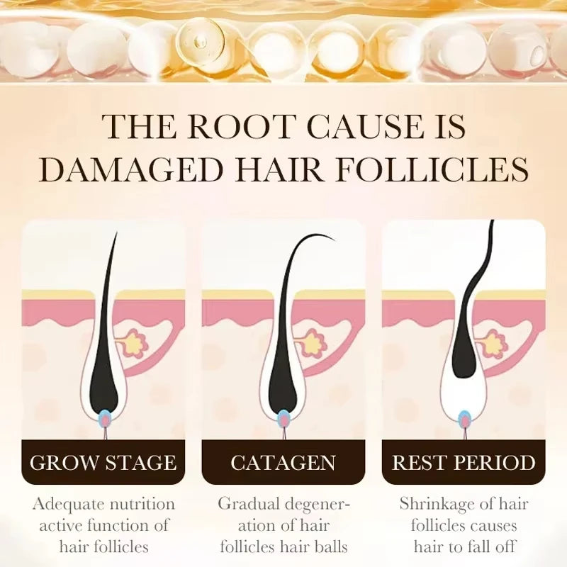 Tratamiento esencial para el crecimiento del cabello, fortalece el cabello, nutre el cuero cabelludo, peso ligero, no graso, mejora la circulación del cuero cabelludo