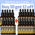 Tratamiento esencial para el crecimiento del cabello, fortalece el cabello, nutre el cuero cabelludo, peso ligero, no graso, mejora la circulación del cuero cabelludo